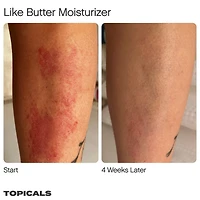 Like Butter Moisturizer for Dry, Sensitive & Eczema-Prone Skin