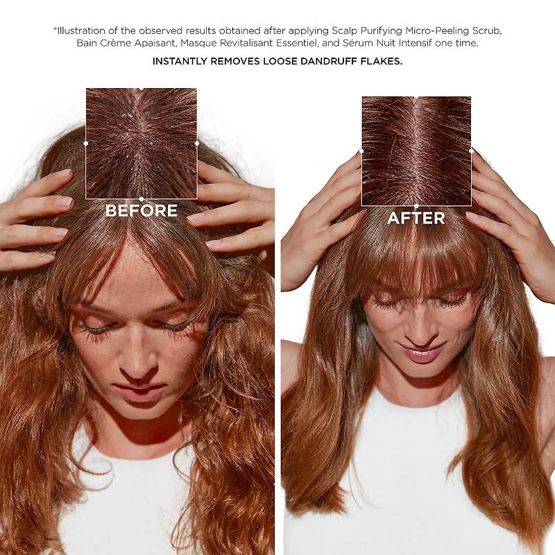 Micro-exfoliant purifiant du cuir chevelu Symbiose