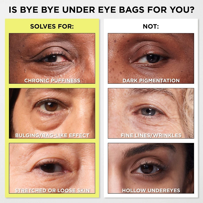 Soin de jour Bye Bye Under Eye Bags pour les poches, le gonflement et l’aspect flétri