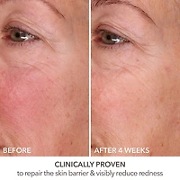 Sérum comblant + régénérant DermInfusions™ avec acide hyaluronique