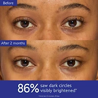 Vinoperfect Dark Circle Brightening Eye Cream with Niacinamide