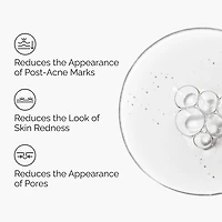 Aloe 2% + NAG 2% Solution for Post-Acne Marks