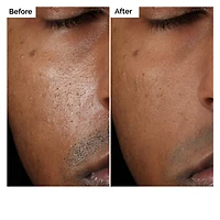 Solution à base de 2 % d’aloès et de 2 % de NAG