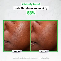 Sérum Ultra Pur High-Potency avec 5 % de niacinamide