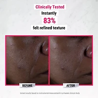 Sérum Ultra Pure High-Potency avec 9,8 % d’acide glycolique