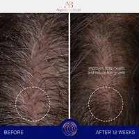 Le système de soin pour les cheveux