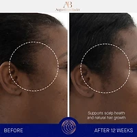 Le système de soin pour les cheveux