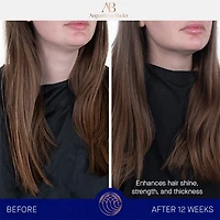Le système de soin pour les cheveux