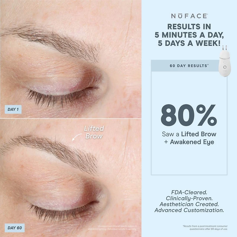 Trinity+® de NuFACE et un accessoire efficace pour les lèvres et les yeux
