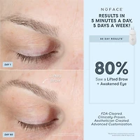 Trinity+® de NuFACE et un accessoire efficace pour les lèvres et les yeux
