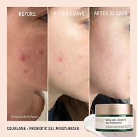 Gel hydratant équilibrant probiotique + squalane