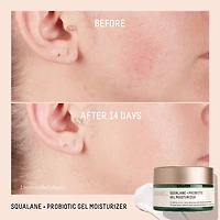 Gel hydratant équilibrant probiotique + squalane