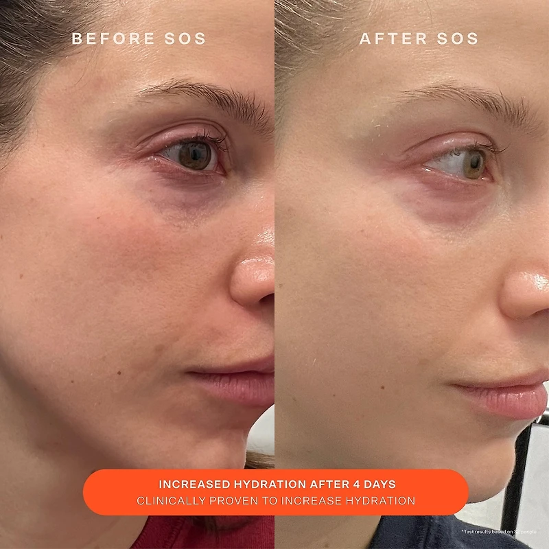 Hydratant réparateur de rougeurs SOS Daily Skin Barrier
