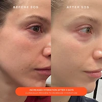 Hydratant réparateur de rougeurs SOS Daily Skin Barrier