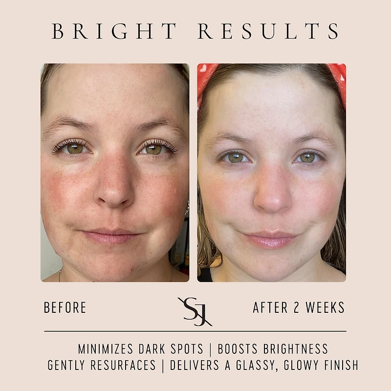 Vitamin C Glow Drops - Brightening Serum with 20% Vitamin C Blend