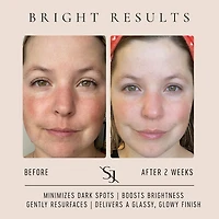Vitamin C Glow Drops - Brightening Serum with 20% Vitamin C Blend