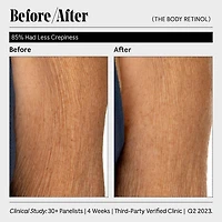 Sérum réparateur au rétinol pour le corps avec 0,1 % de rétinol pur, 10 % AHA + 5 peptides
