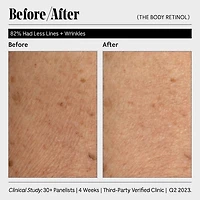 Sérum réparateur au rétinol pour le corps avec 0,1 % de rétinol pur, 10 % AHA + 5 peptides