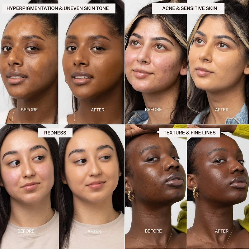 The Foundation Stick for Hydrating, Buildable Coverage and Natural Finish