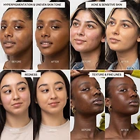 The Foundation Stick for Hydrating, Buildable Coverage and Natural Finish