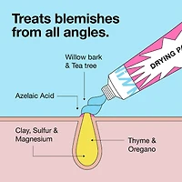 Pimple Paste