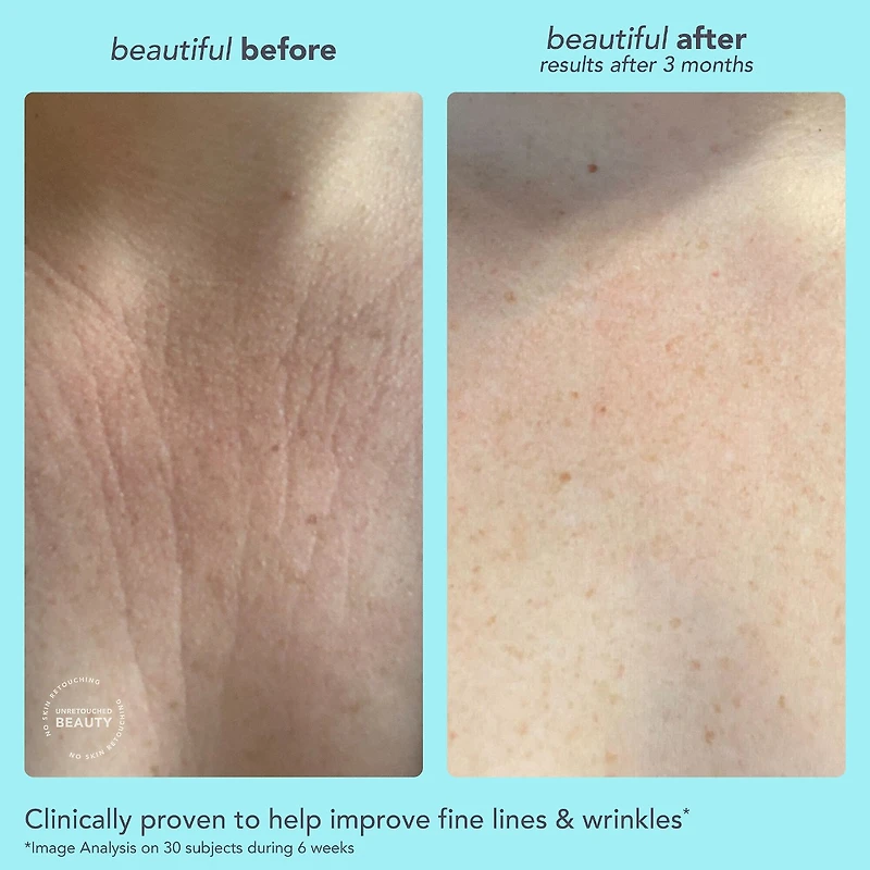 Wrinkle Treatment Drops Retinol Alternative Serum