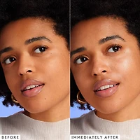 Gouttes illuminatrices avec niacinamide à 5 % B-Goldi™