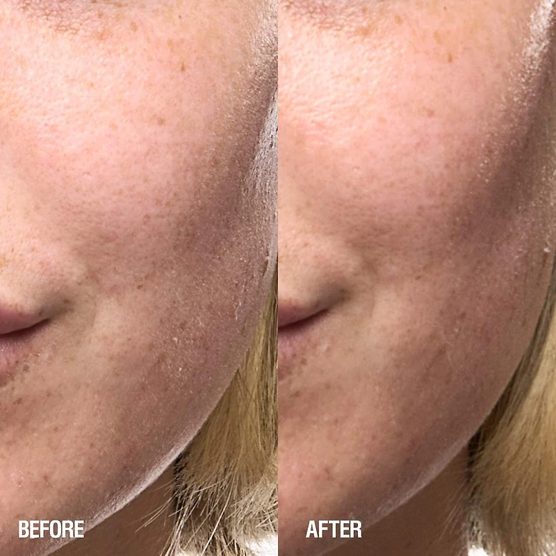 Skin Renewal Anti-oxidant Rich Barrier Serum with Ashwagandha, Niacinamide and Echinacea