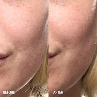 Skin Renewal Anti-oxidant Rich Barrier Serum with Ashwagandha, Niacinamide and Echinacea
