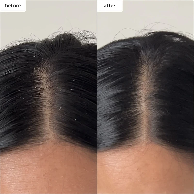 Scalp Revival™ Charcoal + Tea Tree Buildup Detox Spray