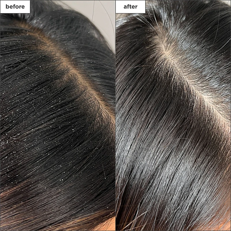 Scalp Revival™ Charcoal + Tea Tree Buildup Detox Spray