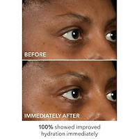 Masque pour les yeux Lift + Repair de DermaInfusions™