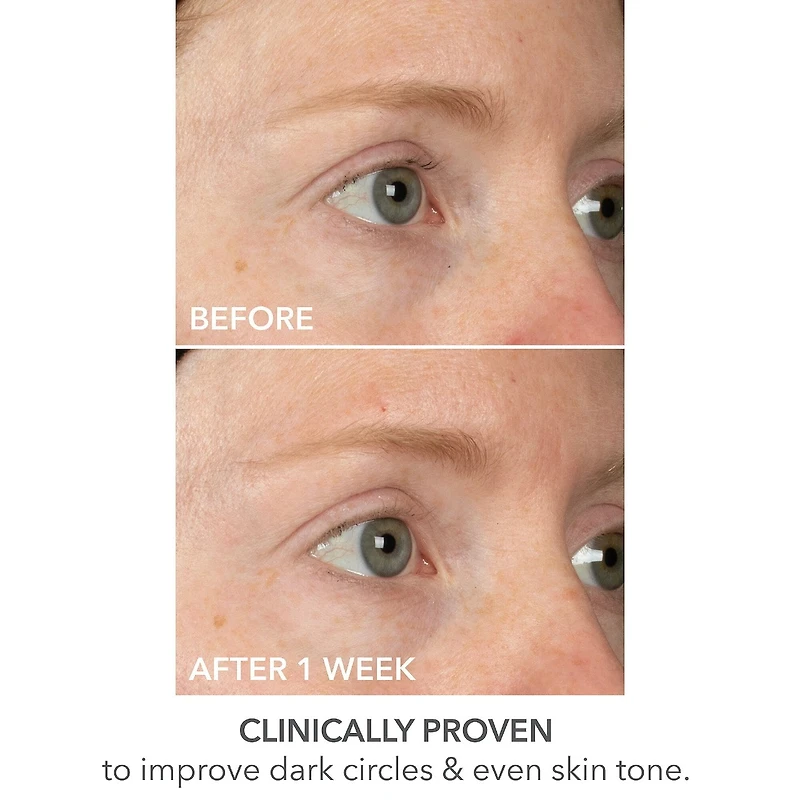 Masque pour les yeux Lift + Repair de DermaInfusions™