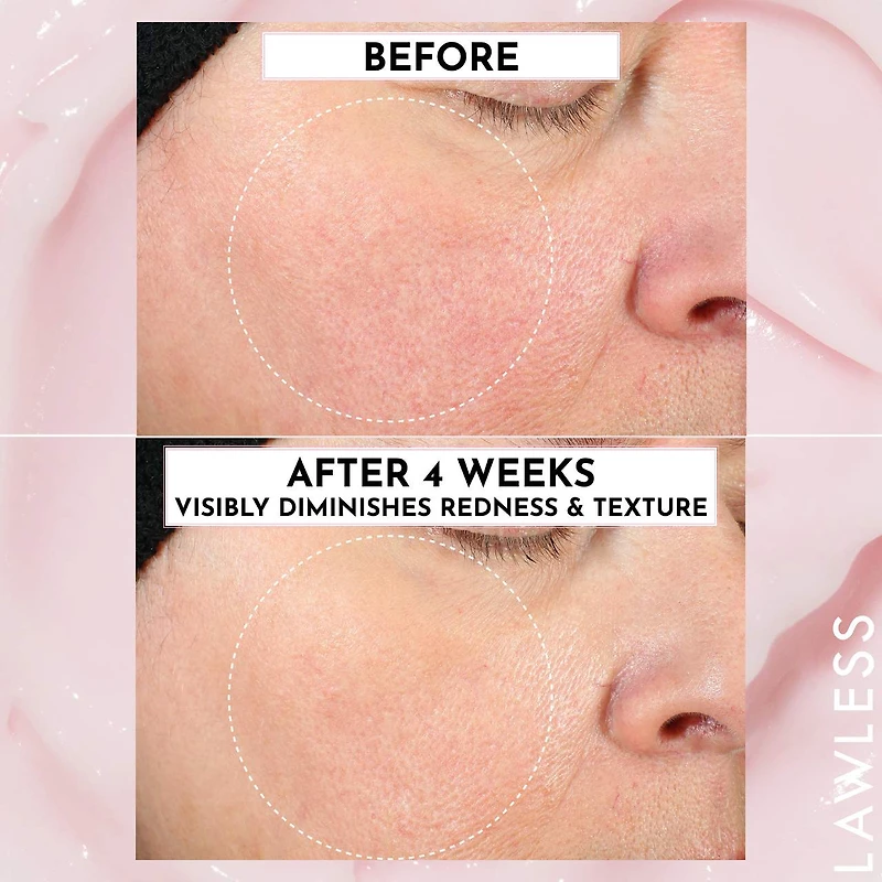 Hydratant et base de maquillage repulpante lissante pour la peau Forget the Filler