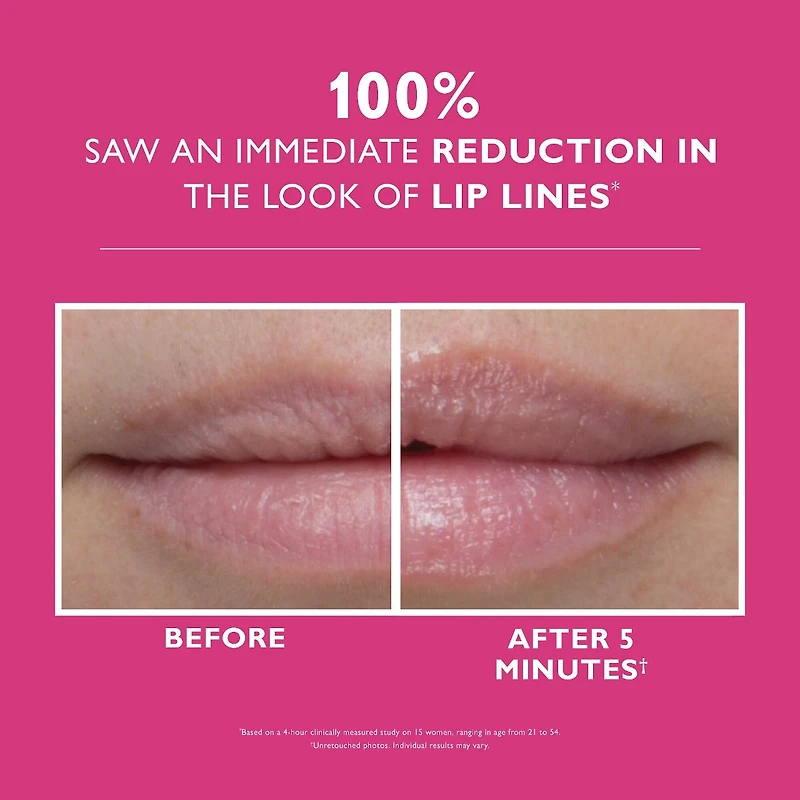 Instant FIRMx® Lip Filler