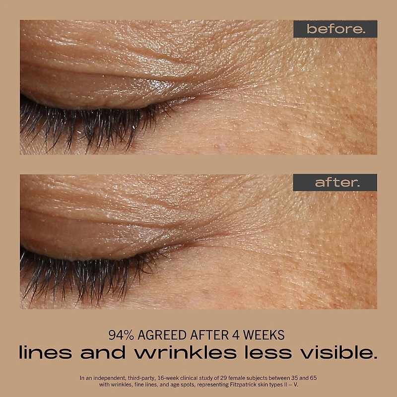 WRINKLE + TEXTURE CONCENTRATE with 0.2% Encapsulated Retinol, Vitamin C & Azelaic Acid