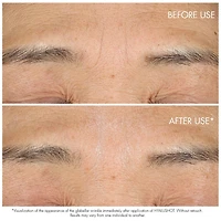 Capture Totale Hyalushot: Wrinkle Corrector with Hyaluronic Acid