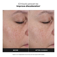 25% Vitamin C + Glutathione Clinical Serum for Brightening & Dark Spots