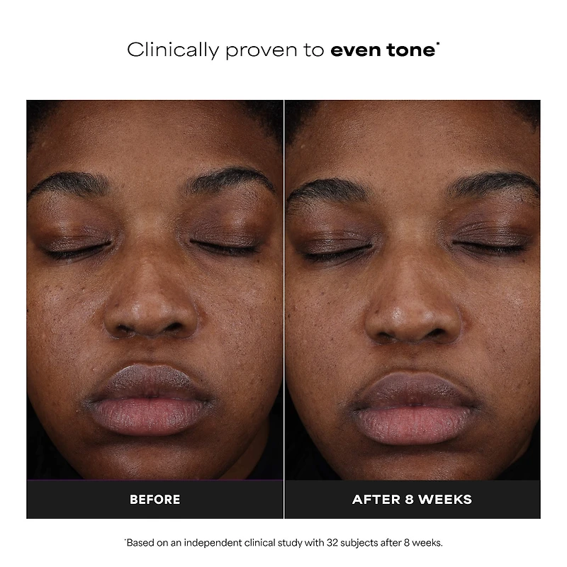 25% Vitamin C + Glutathione Clinical Serum for Brightening & Dark Spots