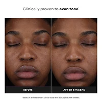 25% Vitamin C + Glutathione Clinical Serum for Brightening & Dark Spots