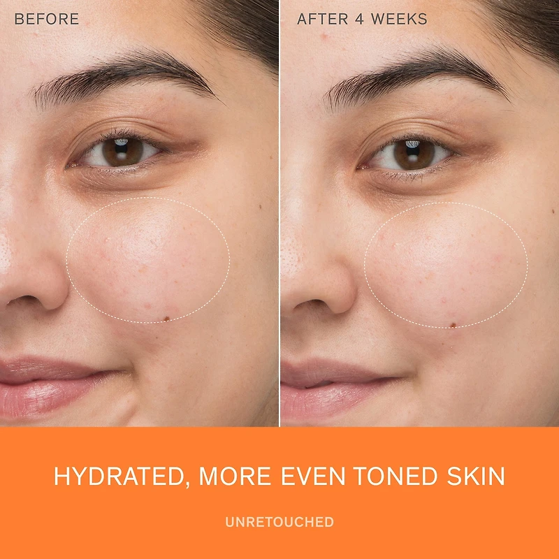 Sérum activateur First Care anti-âge