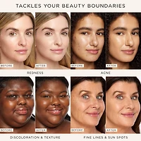 Anticernes radieux shape tape™