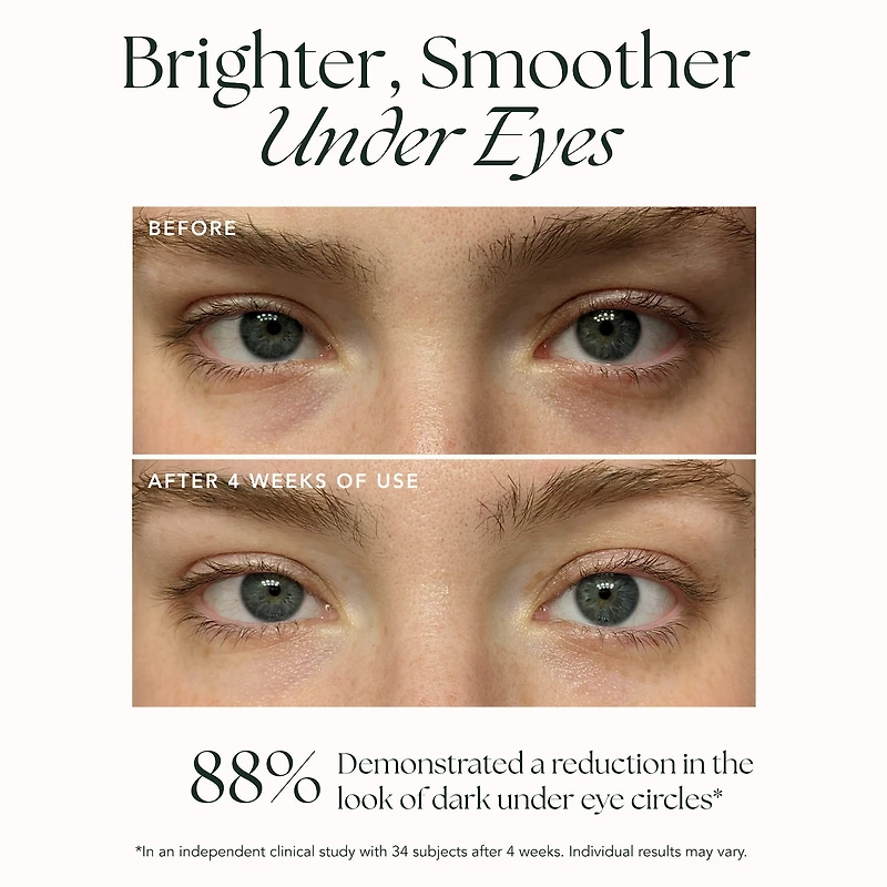 Brightening Retinol Eye Creme for Fine Lines & Dark Circles with Bakuchiol