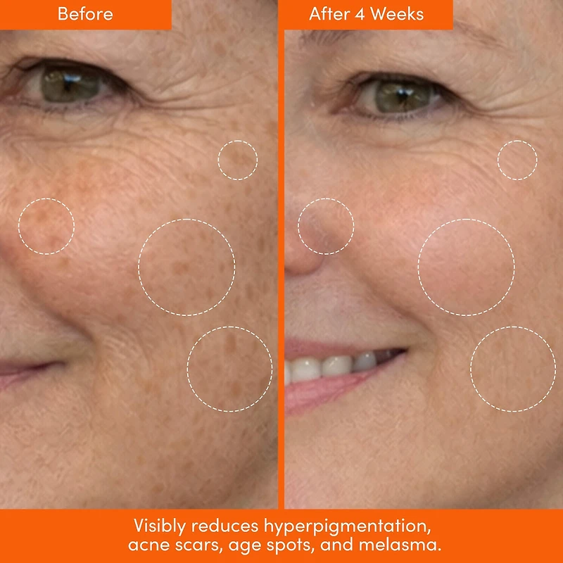 UNSPOTTED 4X Dark Spot + Hyperpigmentation AHA Serum