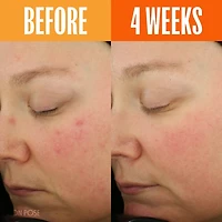 UNSPOTTED 4X Dark Spot + Hyperpigmentation AHA Serum