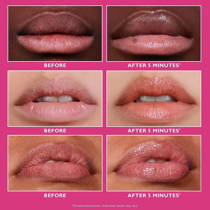 Volumisant instantané des lèvres FIRMx®