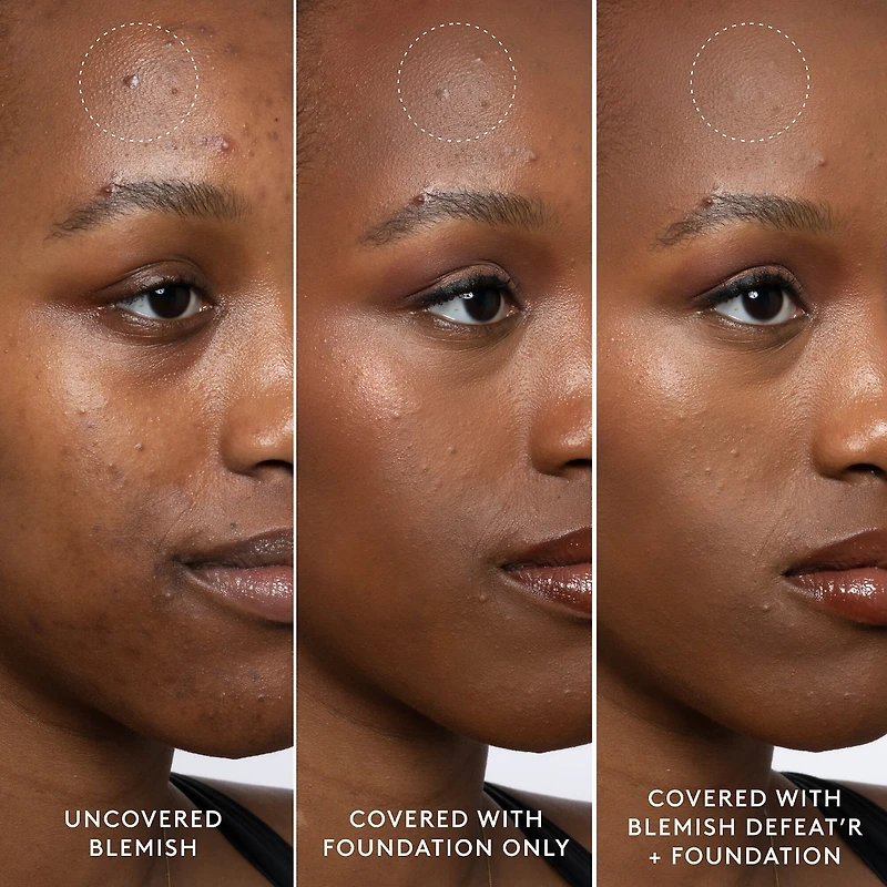 Blemish Defeat'r BHA Spot-Targeting Gel
