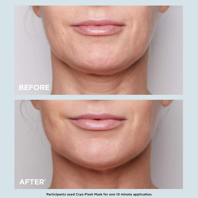 Cryo-Flash Instant Lift Effect & Glow Boosting Face Mask