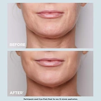 Cryo-Flash Instant Lift Effect & Glow Boosting Face Mask