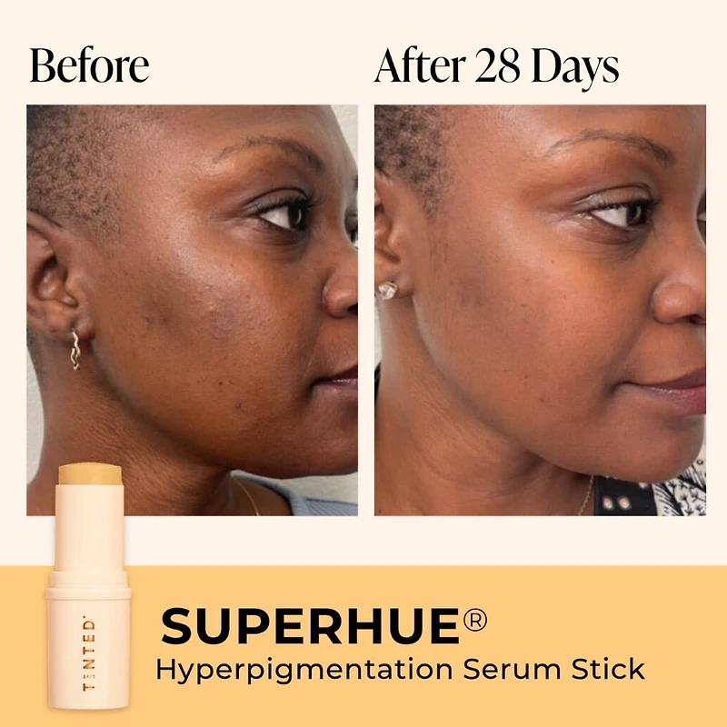 Superhue® Hyperpigmentation Serum Stick